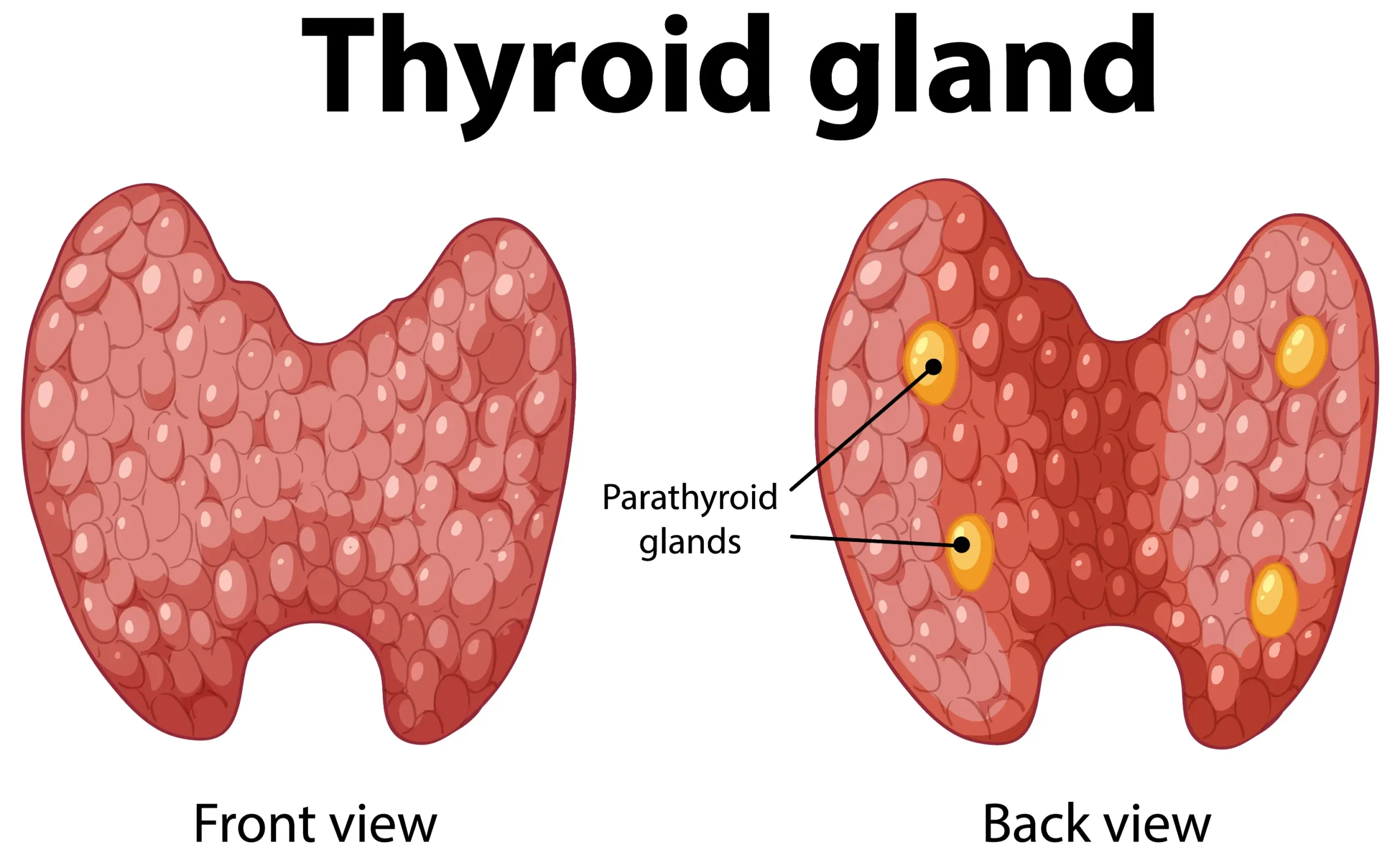 Why Some Gallbladder Infections Are Becoming More Severe in Lebanon