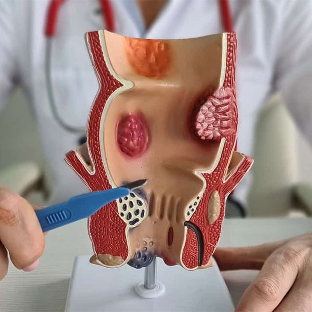 Proctology