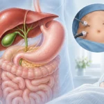 Medical illustration of the liver, gallbladder and bile ducts beside a patient recovering after laparoscopic gallbladder surgery.